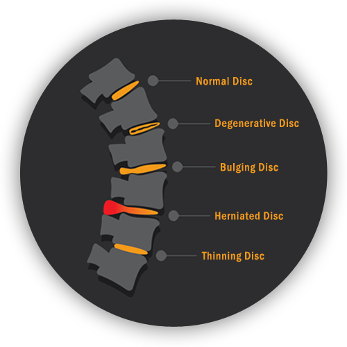 b1-back-pain-spine-graphic.png b1-back-pain-spine-graphic.png